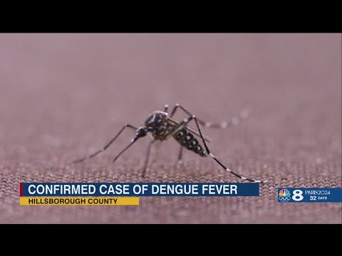 Local case of dengue fever from mosquito bite confirmed in Hillsborough County
